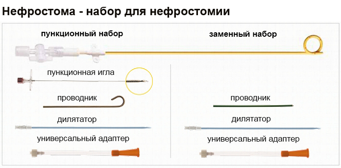 нефростома
